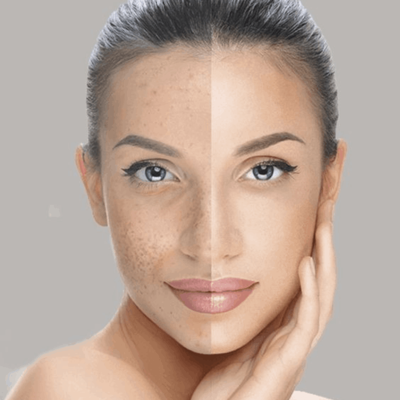 Clínica Estética Clínica Estética Peeling BH